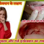 Symptoms-of-throat-infection-in-hindi.webp
