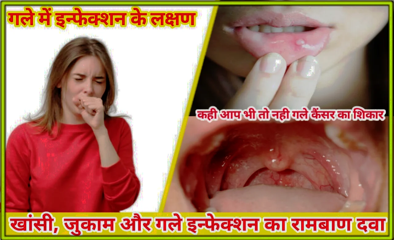 Symptoms-of-throat-infection-in-hindi.webp